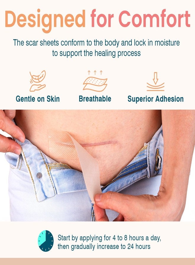 Adamson Premium Silicone Scar Tape for Surgical Marks - Reusable & Professional Silicone Scar Sheets - Medical Tape for Keloid, C-Section, Burns & More - All Skin Types (1.6"x 60" Roll-1.5M) - Image 3